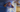 Obstructive Sleep Apnea, Its Symptoms, and Treatment